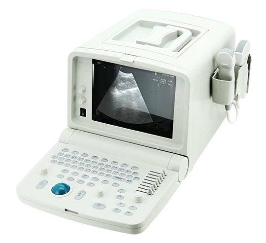 便携式B超机CMS600C