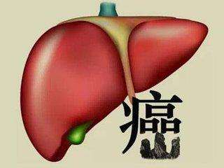 原发性肝癌和继发性肝癌的区别？