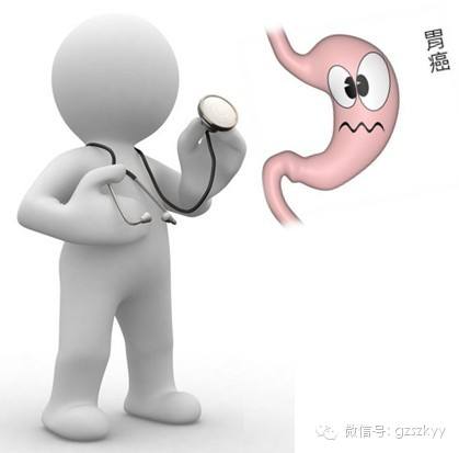 胃癌是怎样发生的？