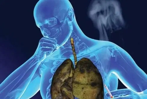 肺癌是如何扩散是