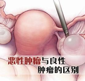 脑瘤是什么原因导致的